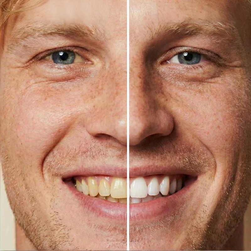 🏆2026 New Arrivals - 50% Off!🧴Instant Whitening Tooth Paint😁🦷